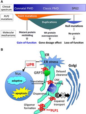 Cellular Pathology of Pelizaeus-Merzbacher Disease Involving Chaperones Associated with Endoplasmic Reticulum Stress